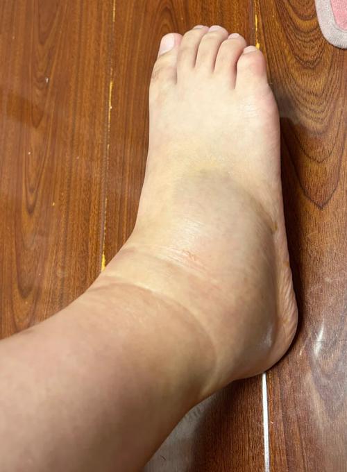 右脚踝扭伤！加福德：当时我踩到了浓眉脚上 意外总会发生